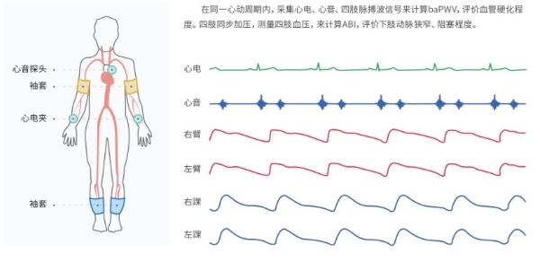 動(dòng)脈硬化檢測(cè)