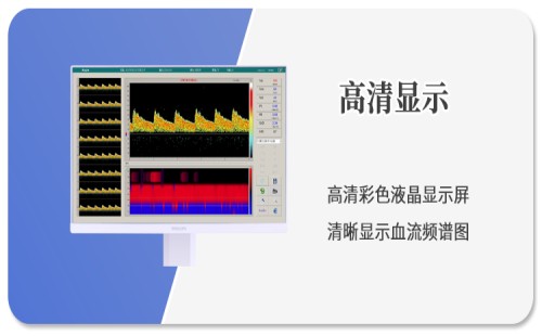 高清顯示屏